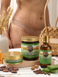 Stretch marks